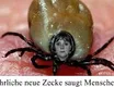 Gefährliche neue Zecke saugt Menschen aus