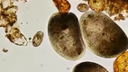 Ein Tropfen Meerwasser unter dem Mikroskop